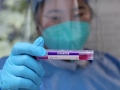 中 한달 째 신규 본토 확진 ‘제로’… 4번째 국산 백신 출시